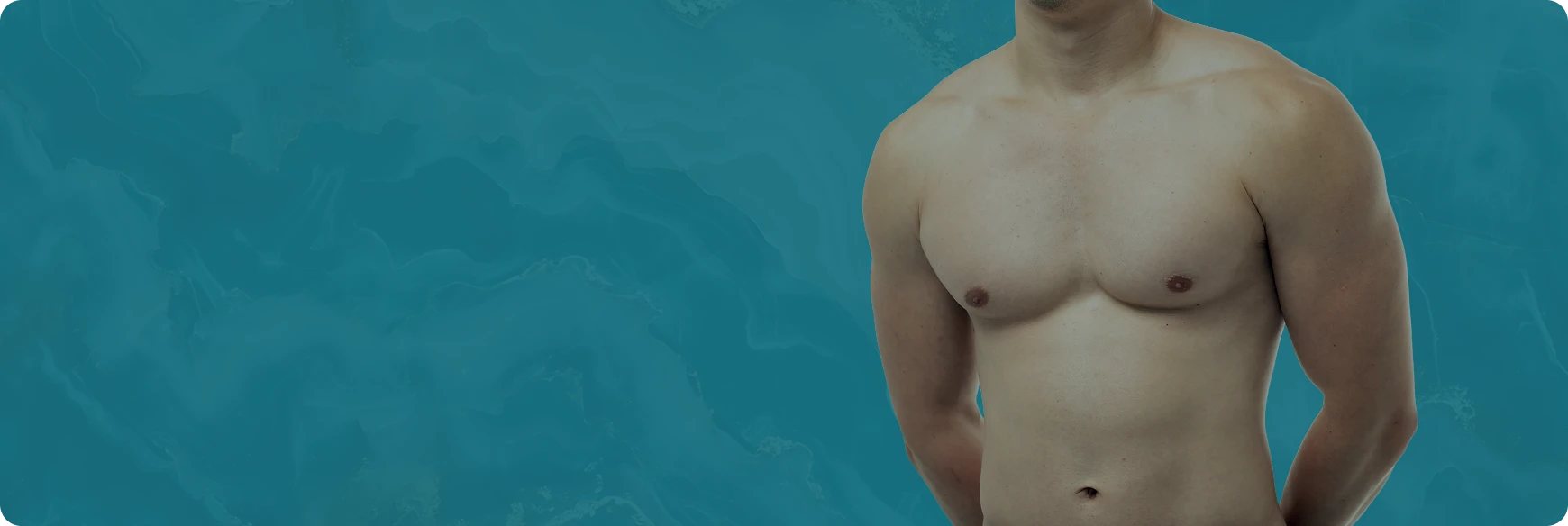 Gynecomastia Surgery
