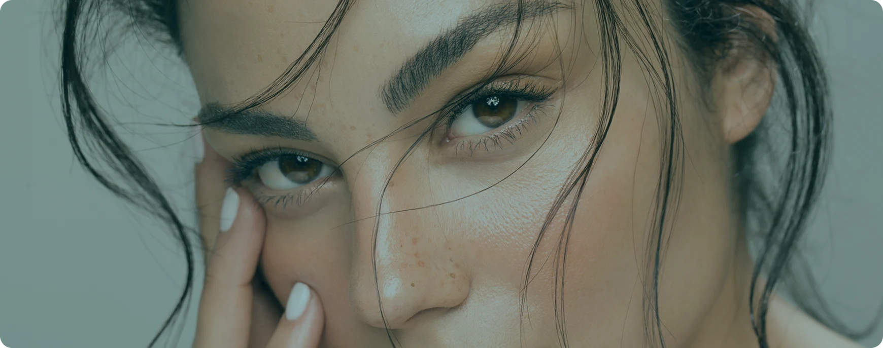 Eyelid Concerns